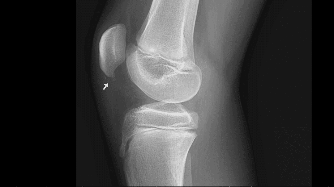 Image radiographique