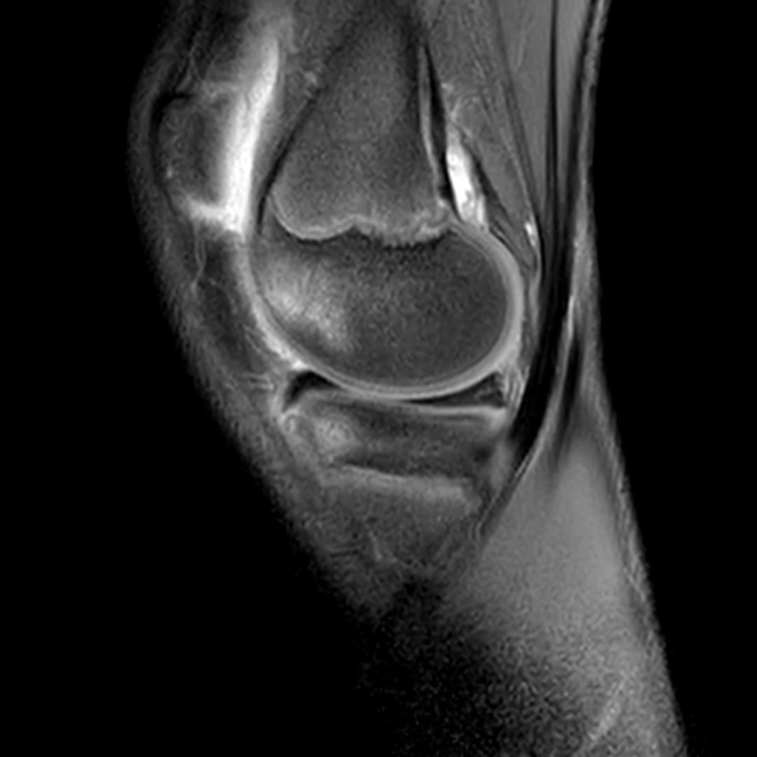 Image IRM