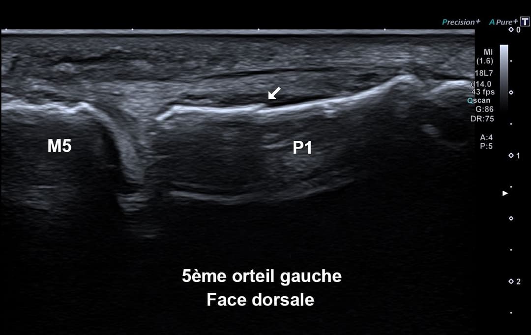 Image échographique