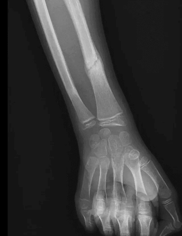 Image radiographique