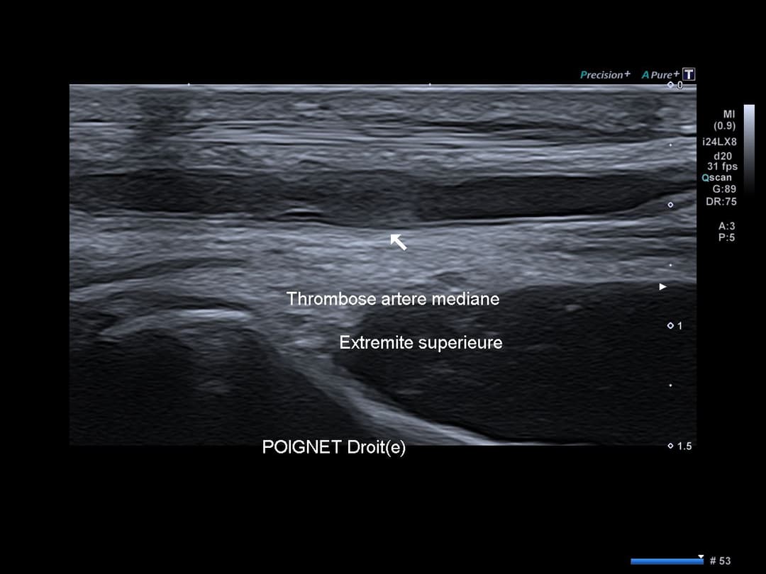 Image échographique