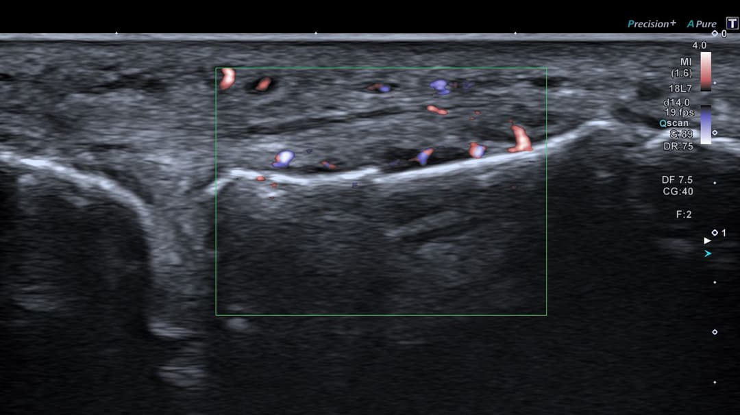 Image échographique