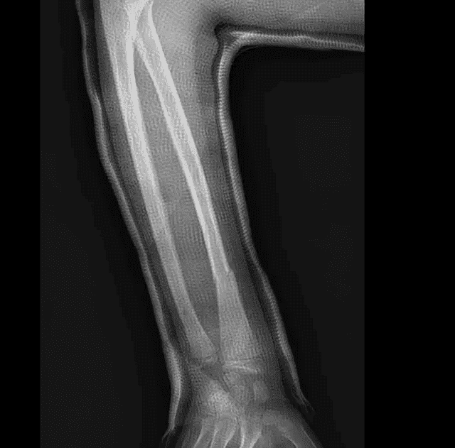 Image radiographique