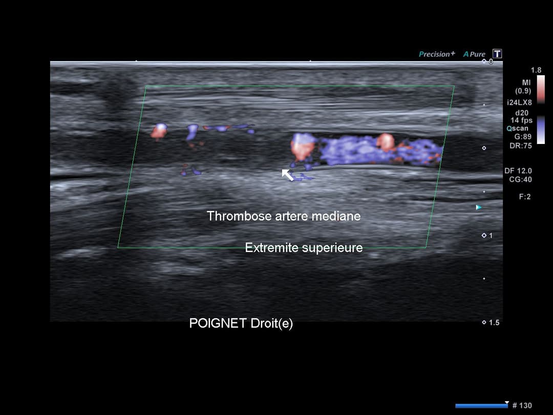 Image échographique