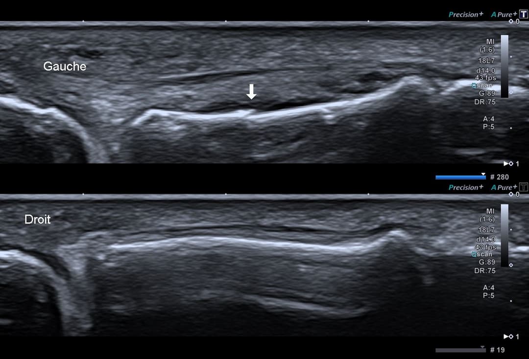 Image échographique