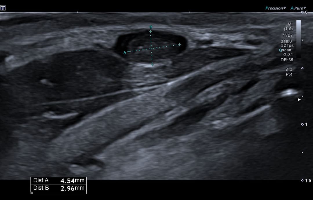 Image échographique