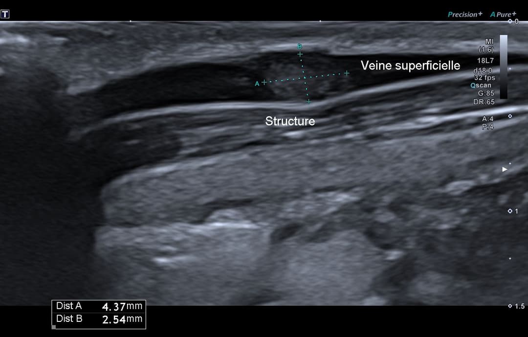 Image échographique