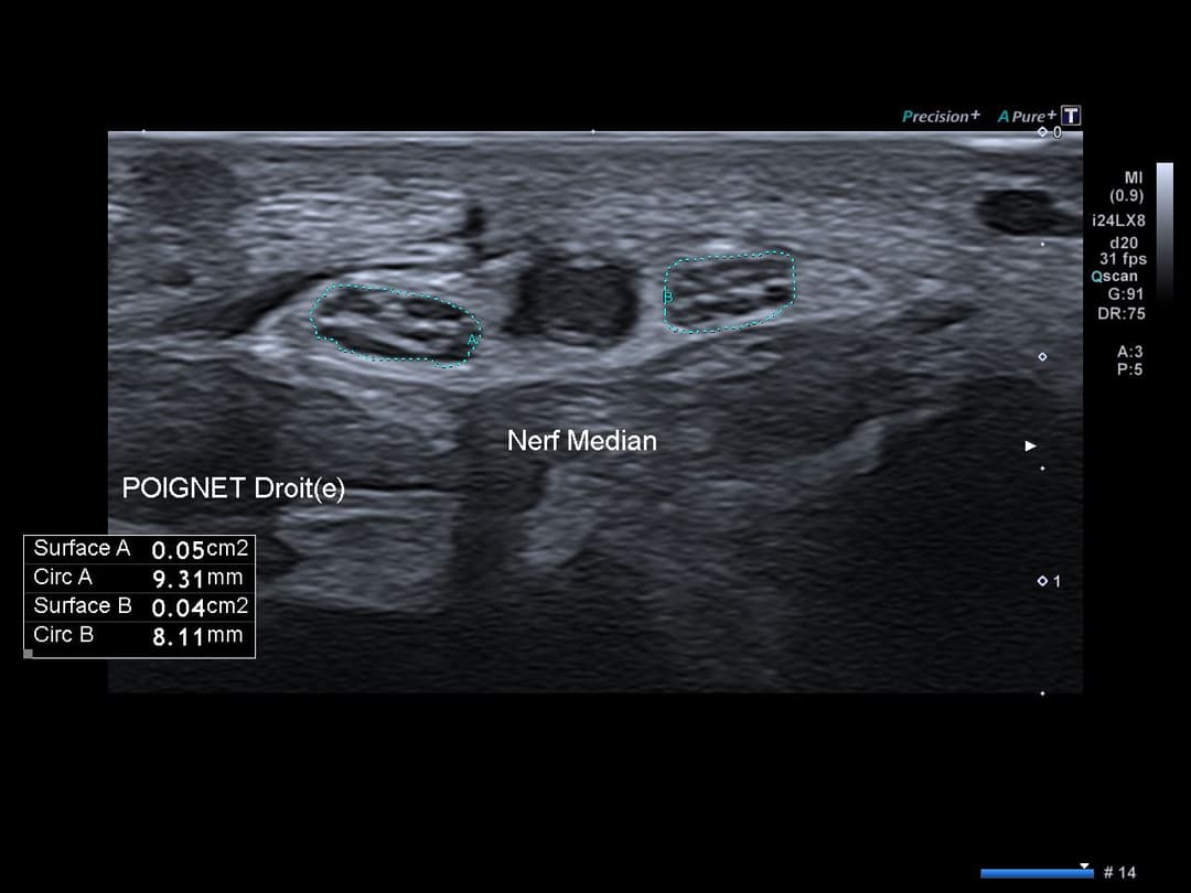 Image échographique