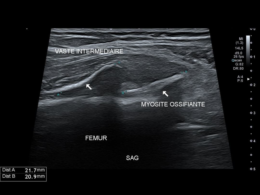 Image échographique