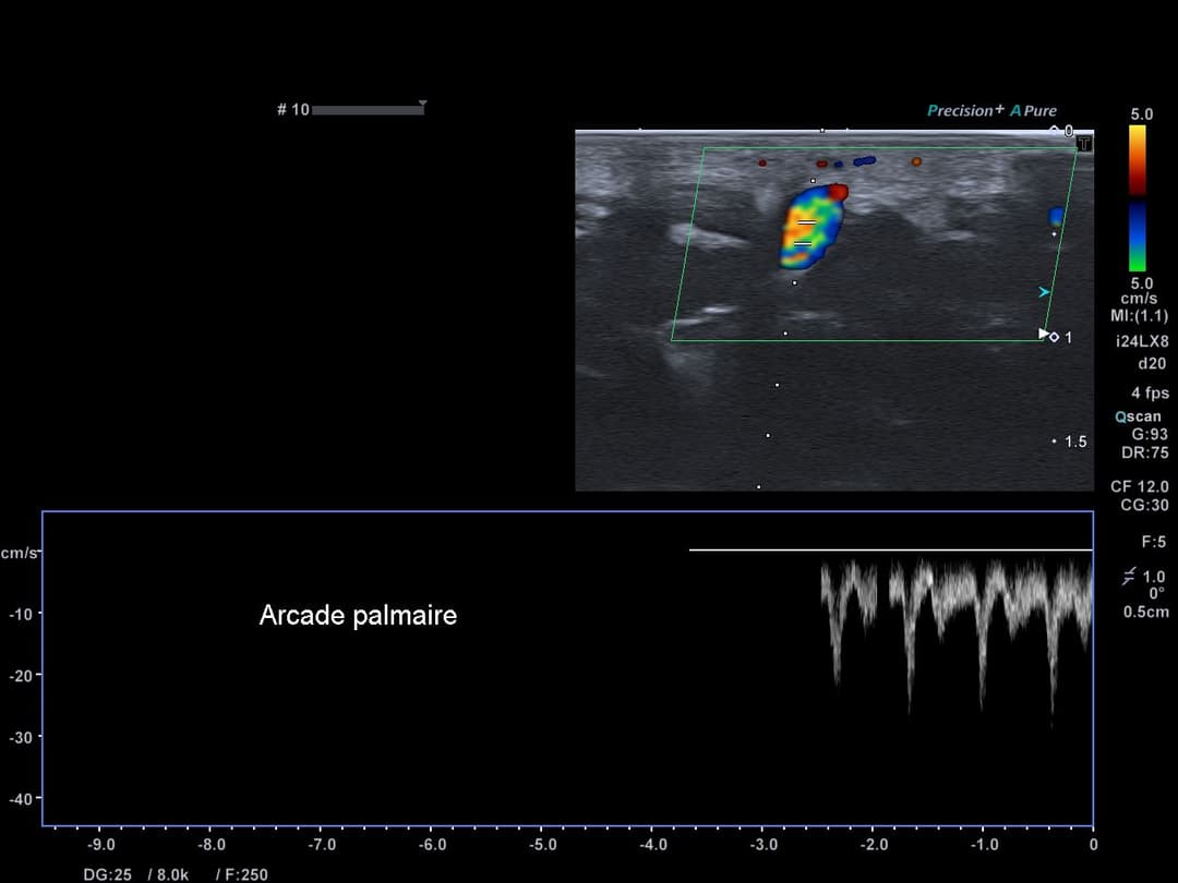 Image échographique