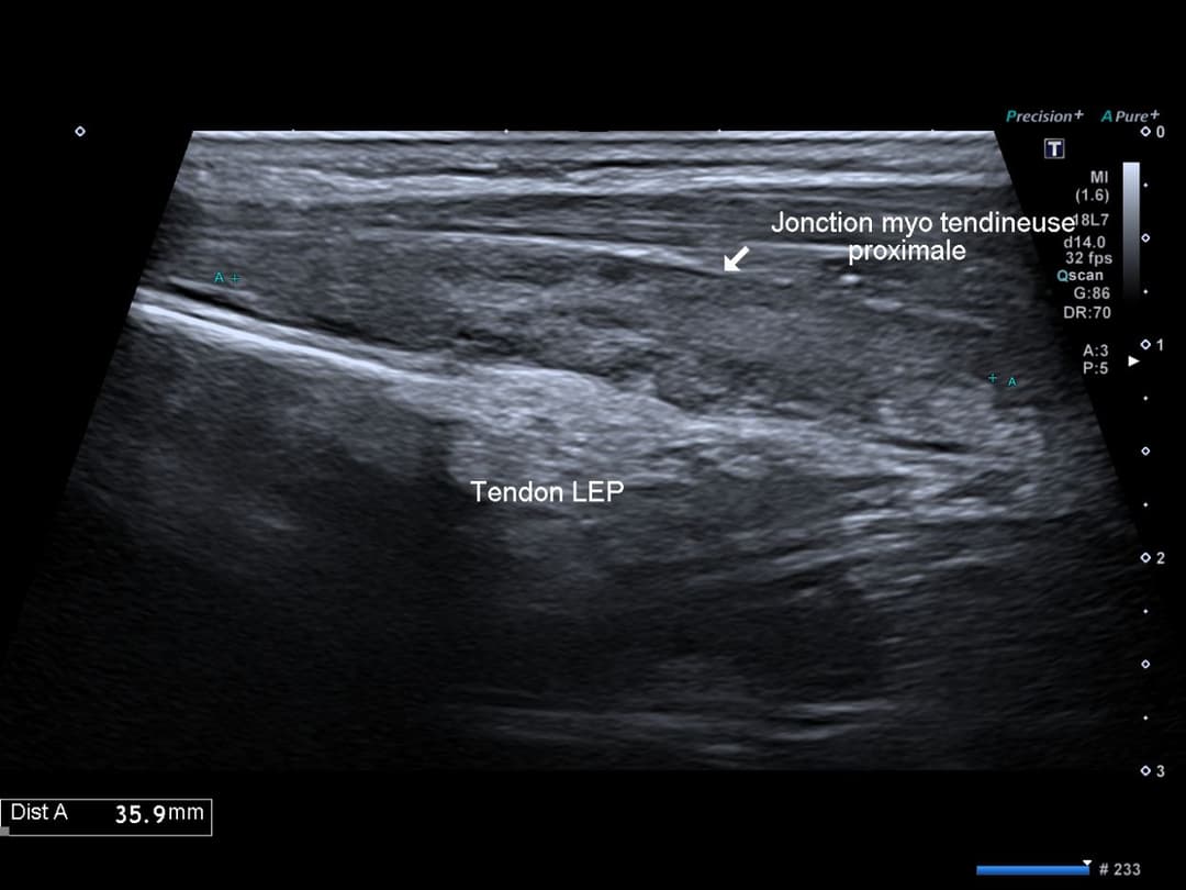 Image échographique