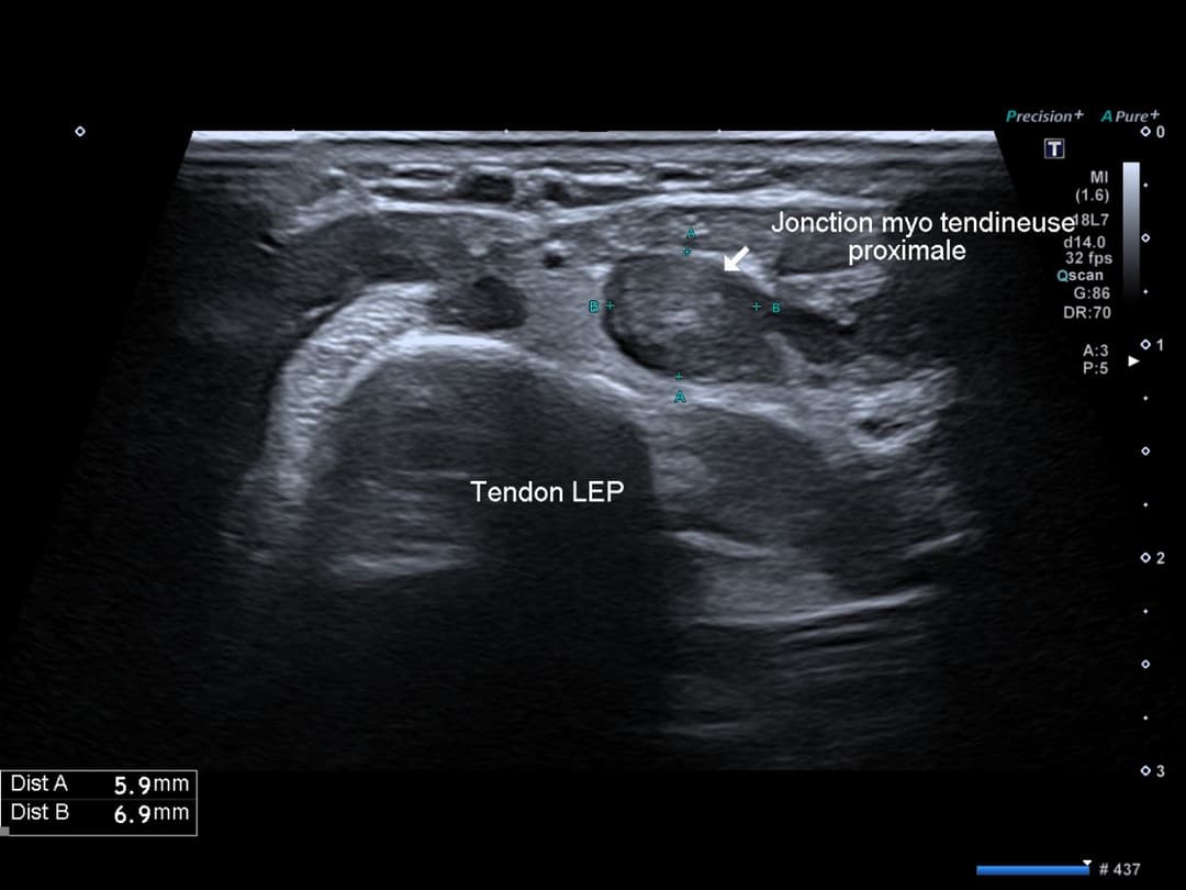 Image échographique