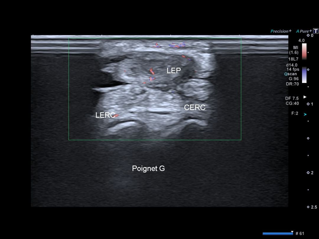 Image échographique