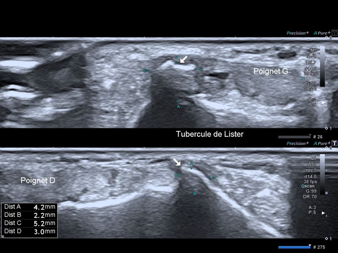 Image échographique