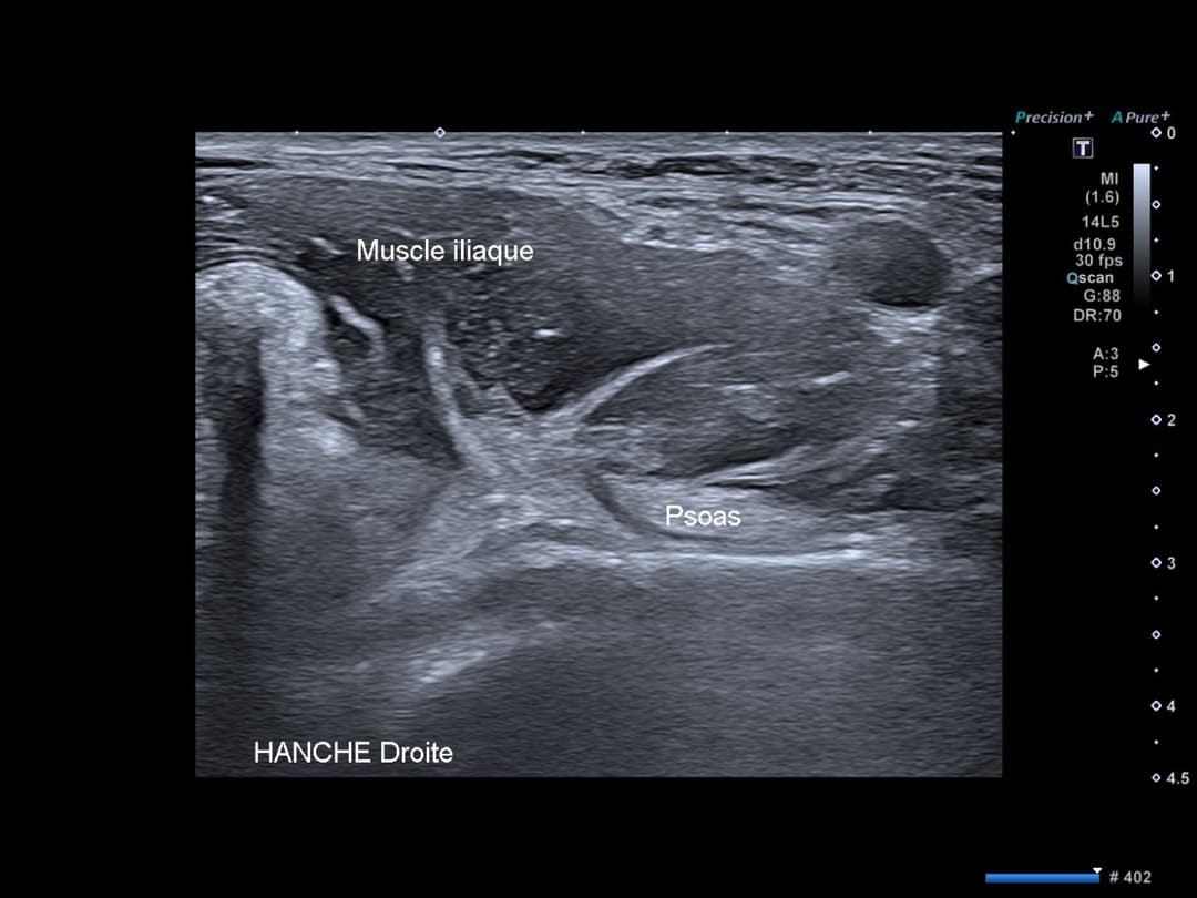 Image échographique