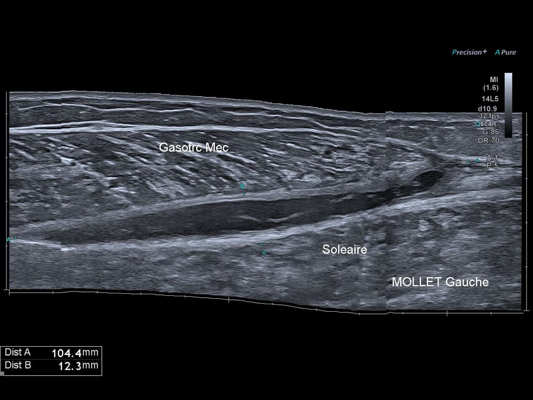 Image échographique