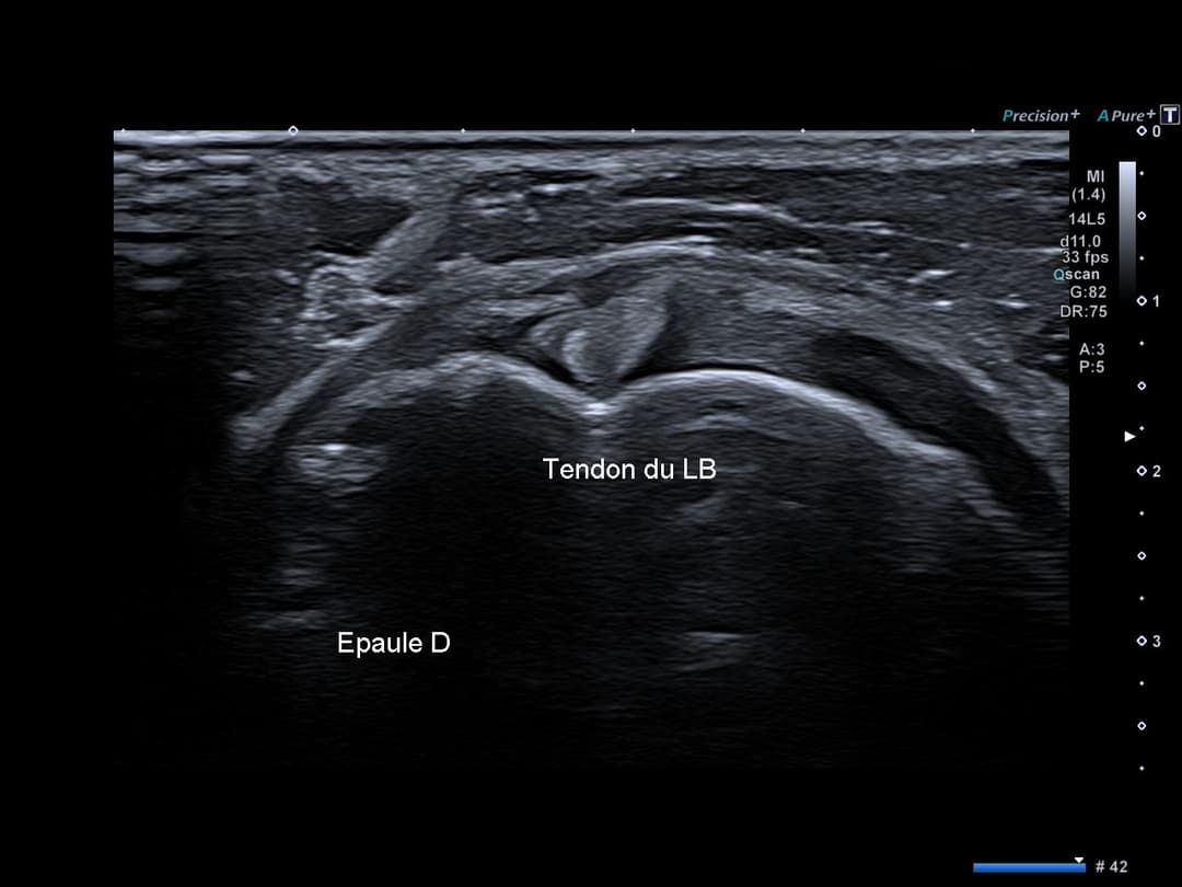 Image échographique