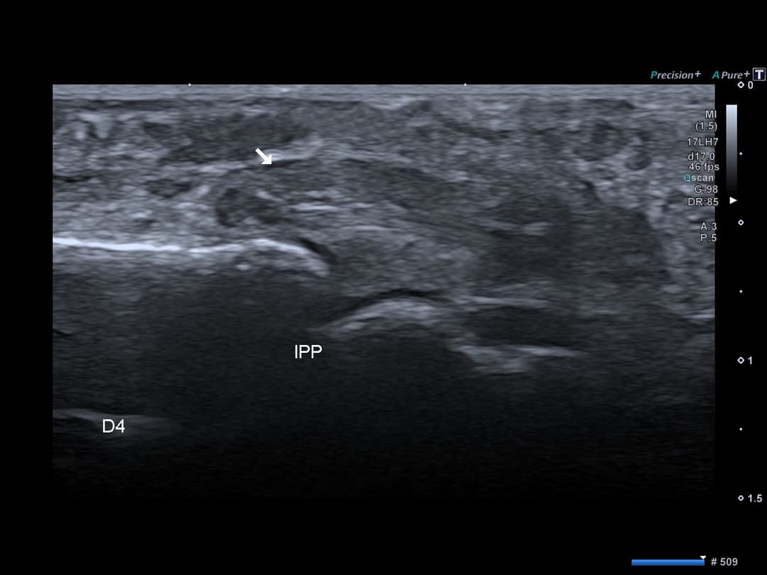 Image échographique