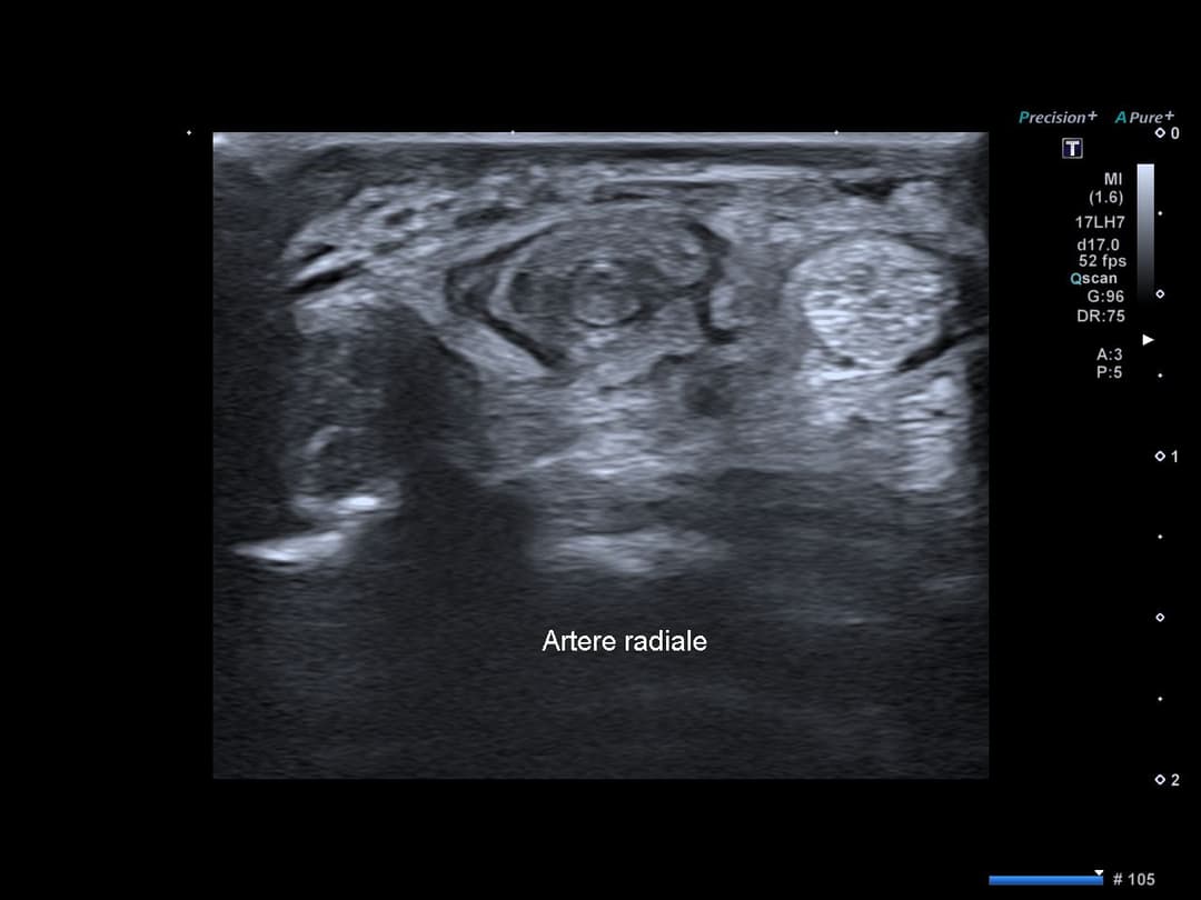 Image échographique