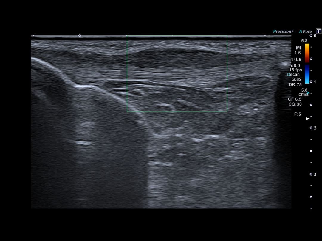 Image échographique