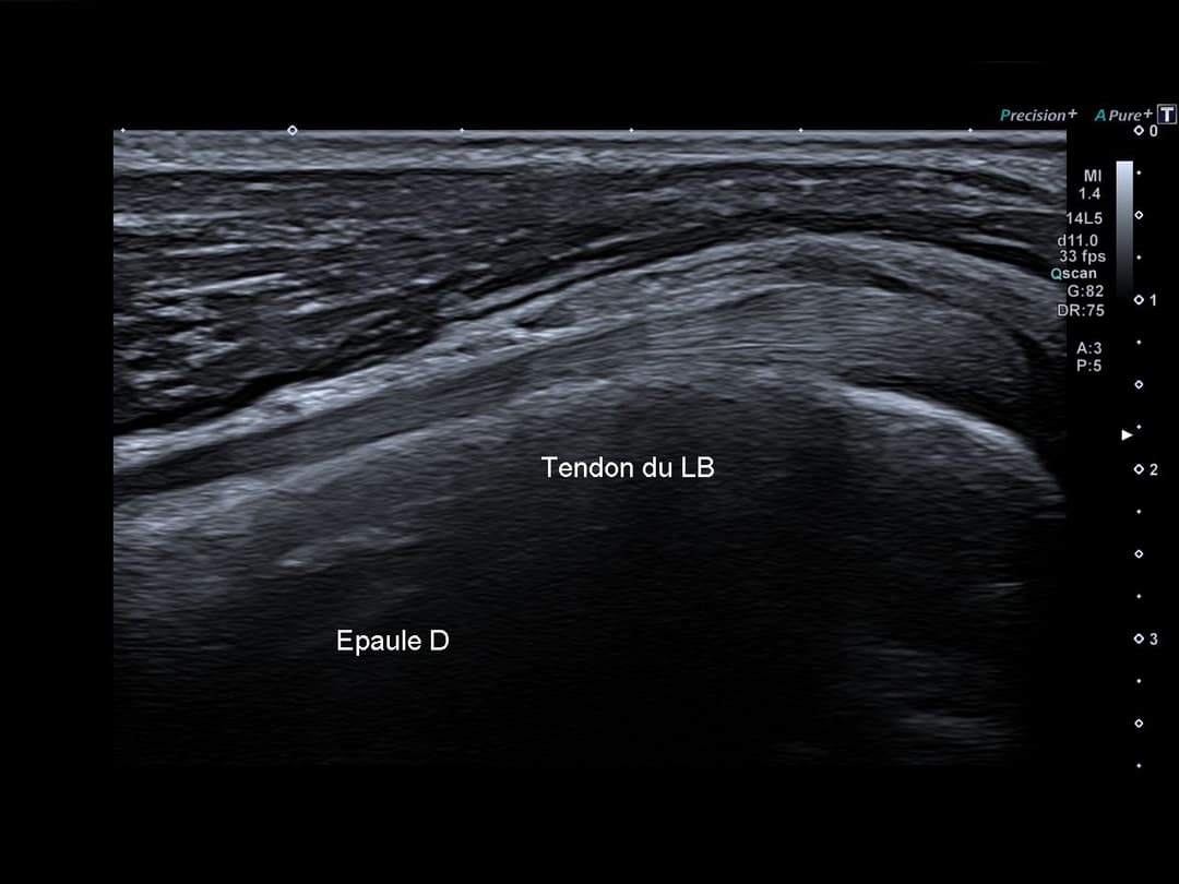 Image échographique