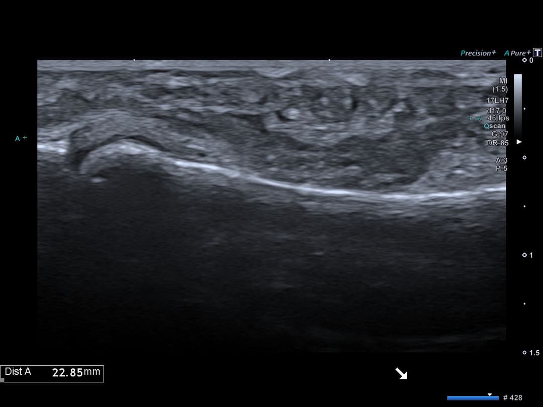 Image échographique