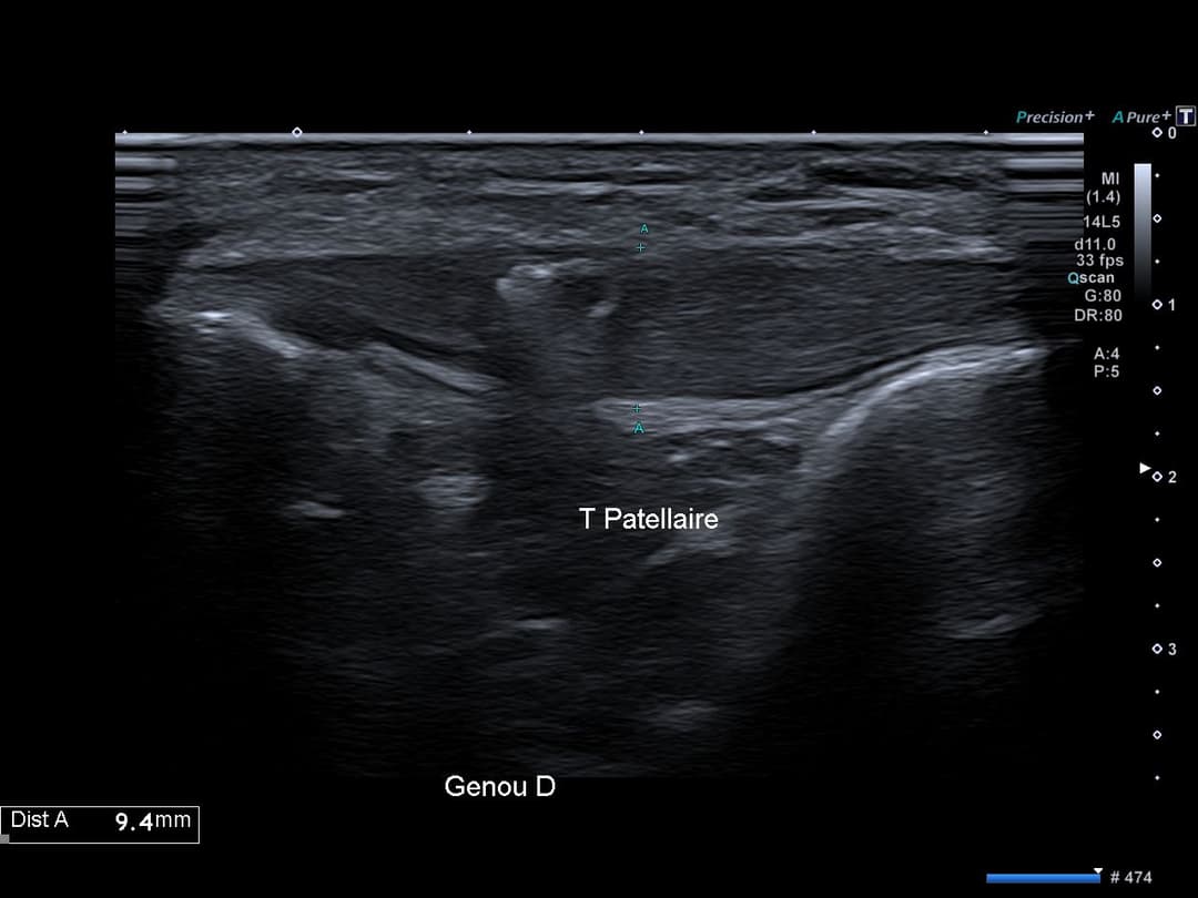 Image échographique