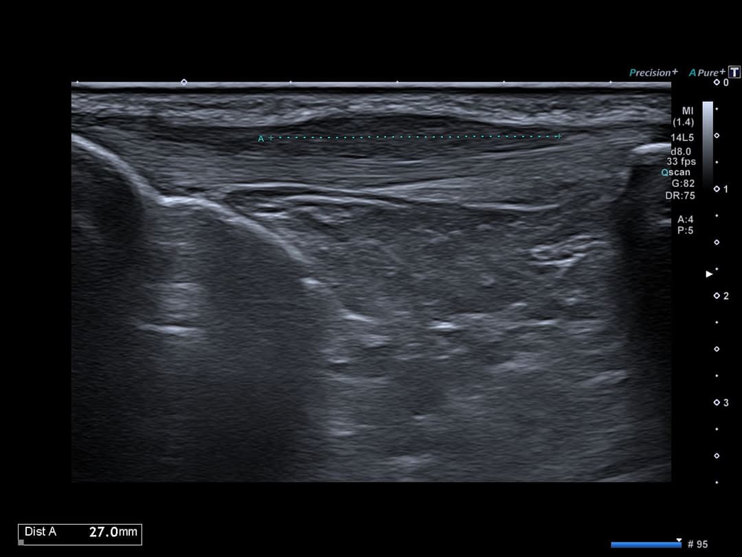 Image échographique