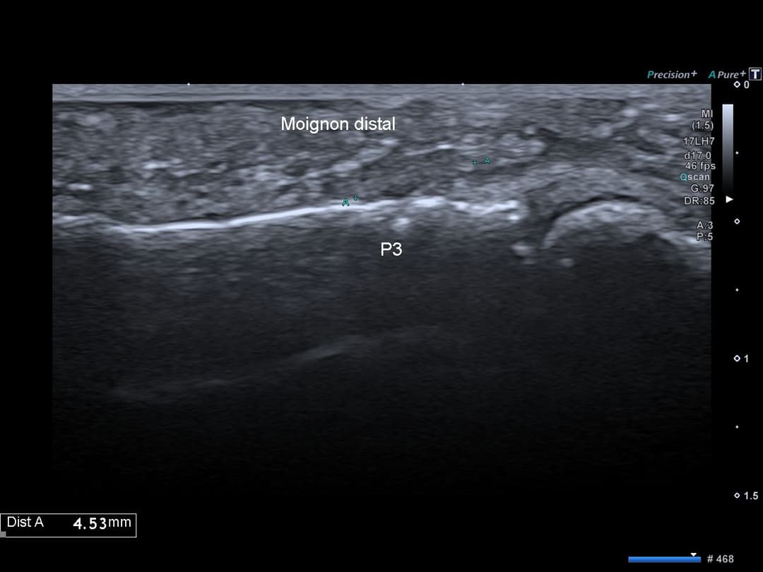 Image échographique