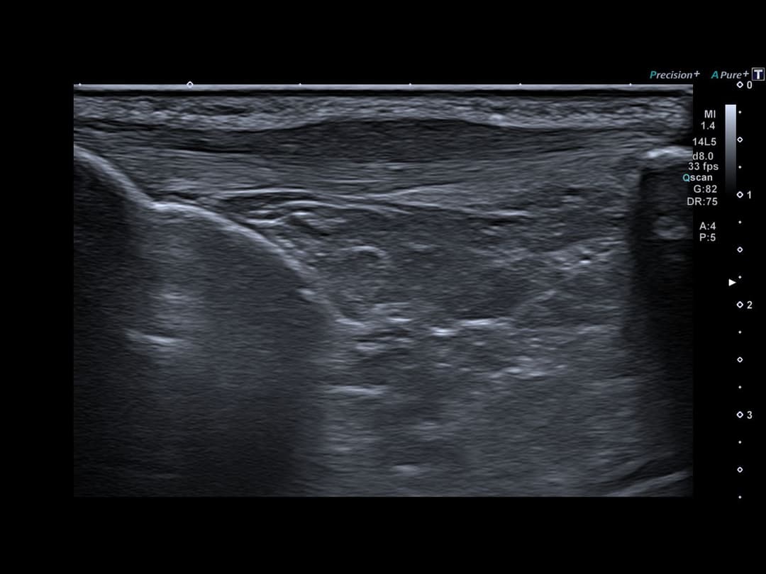 Image échographique