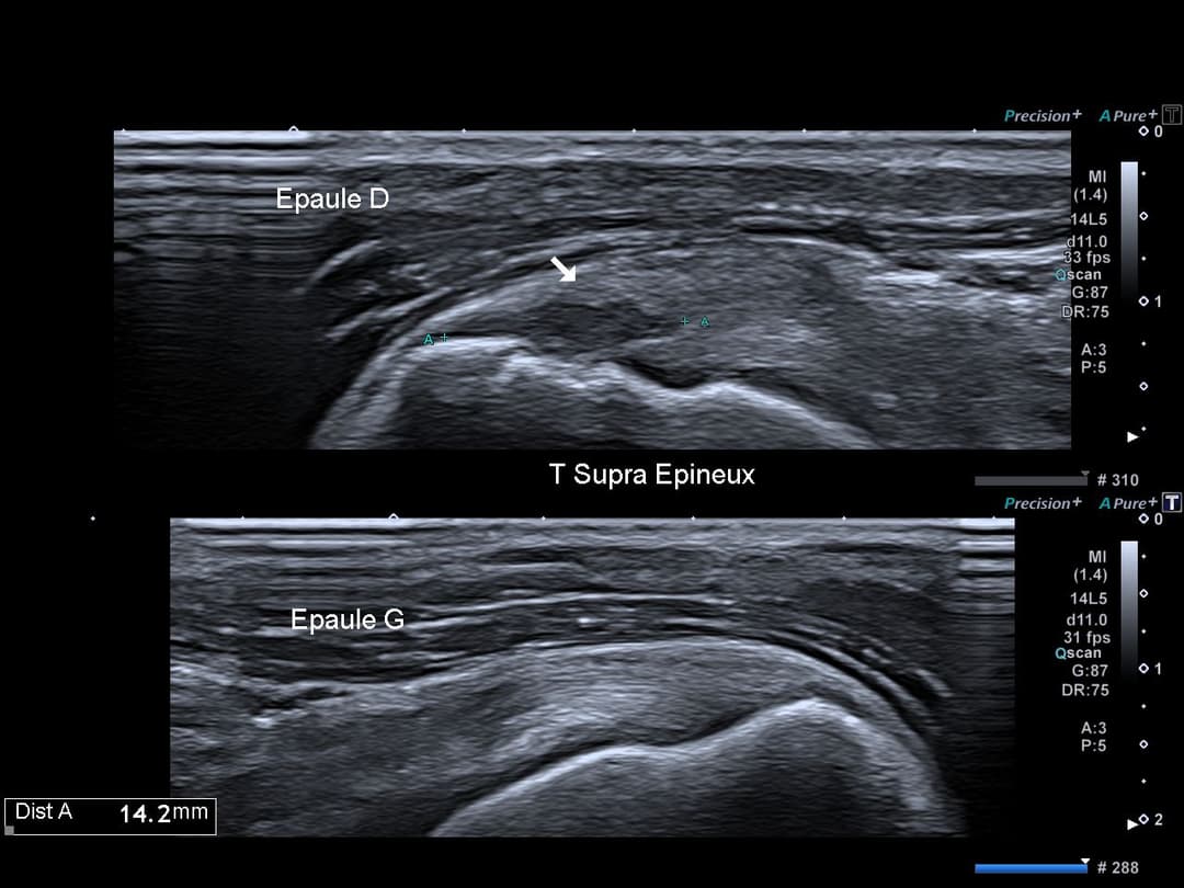Image échographique