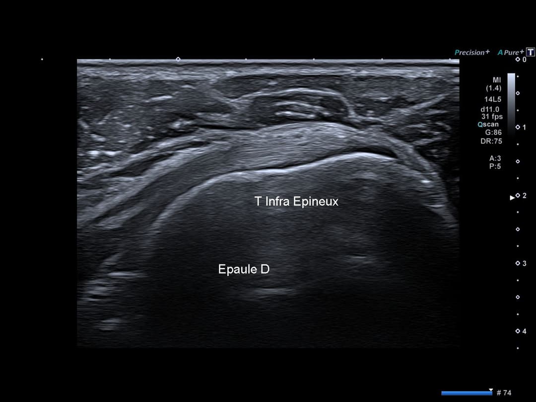 Image échographique