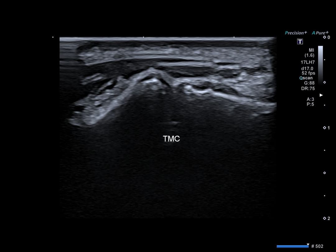 Image échographique