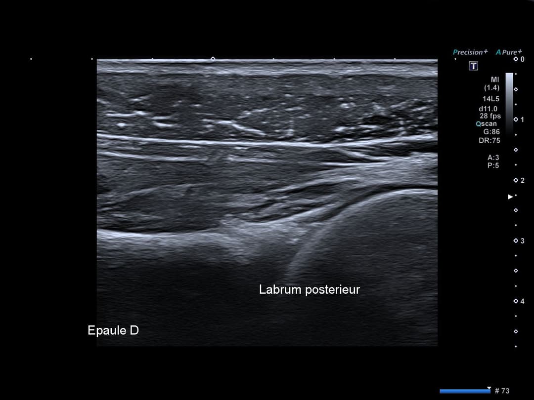 Image échographique