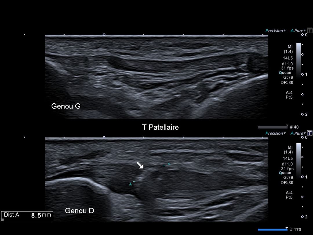 Image échographique