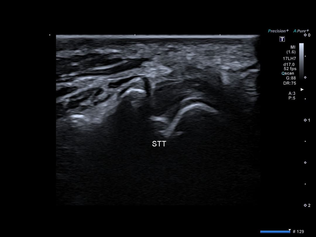 Image échographique