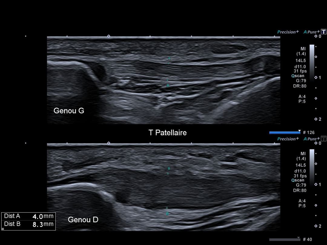 Image échographique