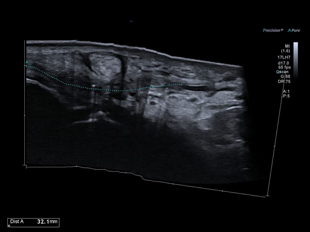Image échographique