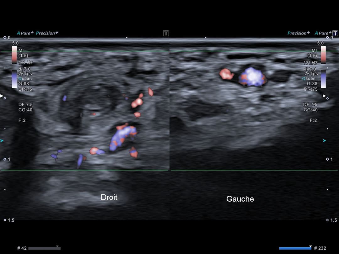 Image échographique