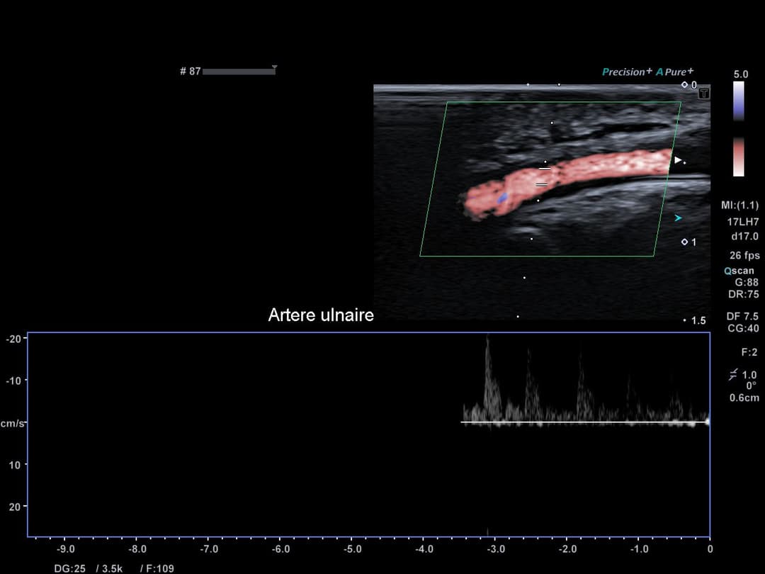 Image échographique