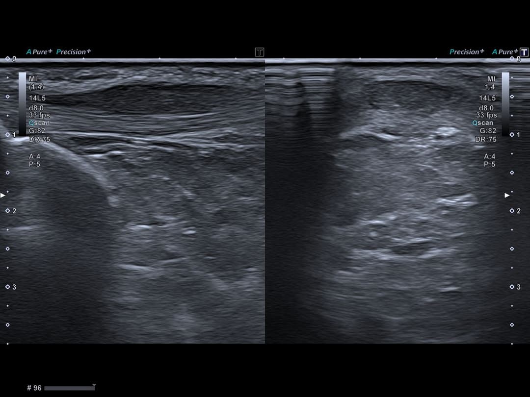 Image échographique