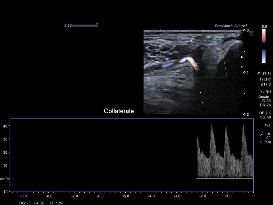 Image échographique