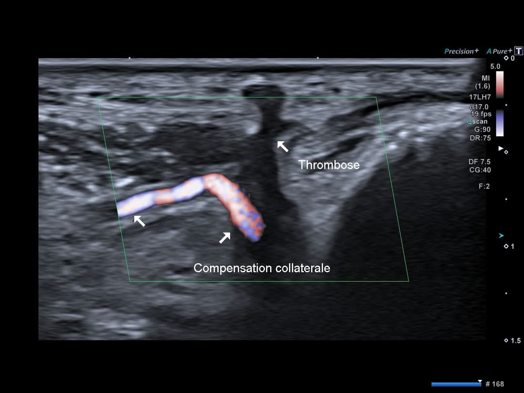 Image échographique