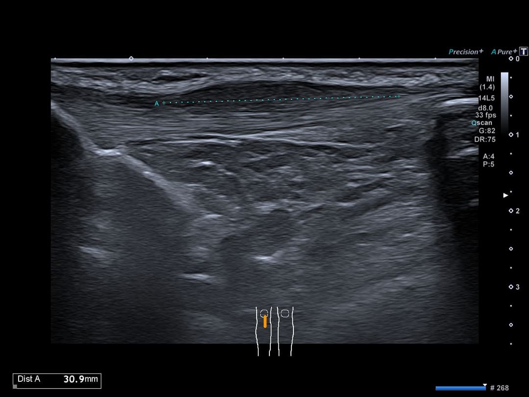 Image échographique