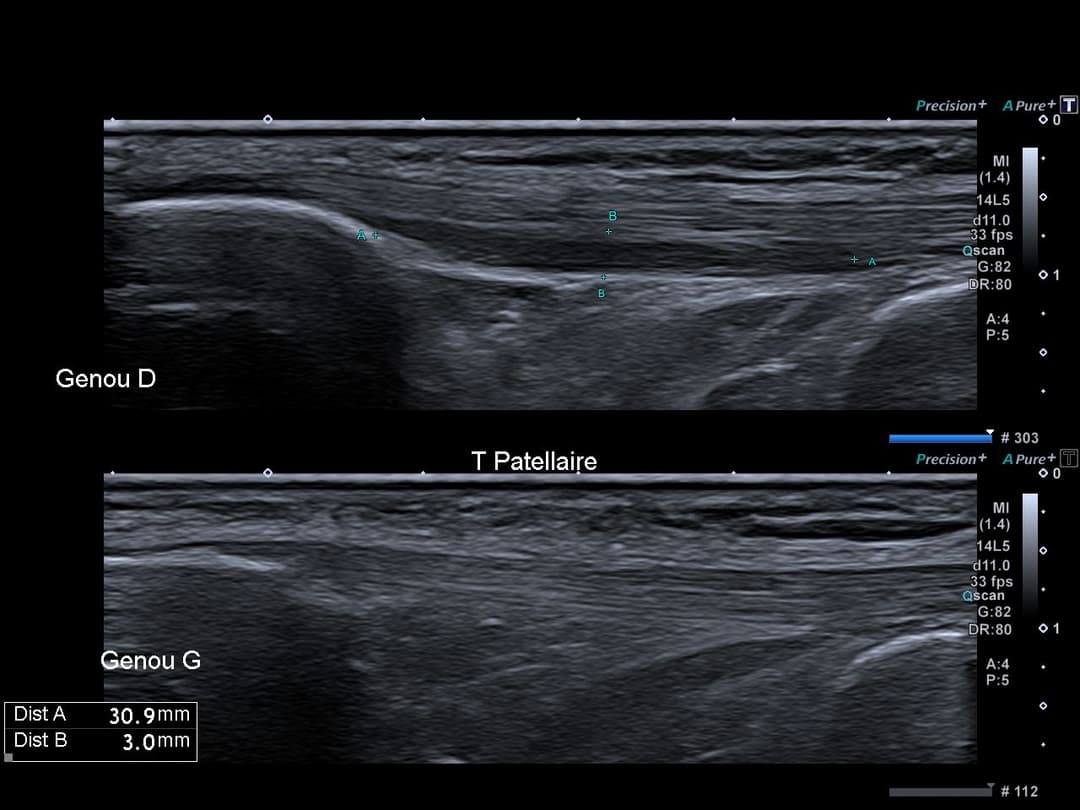 Image échographique