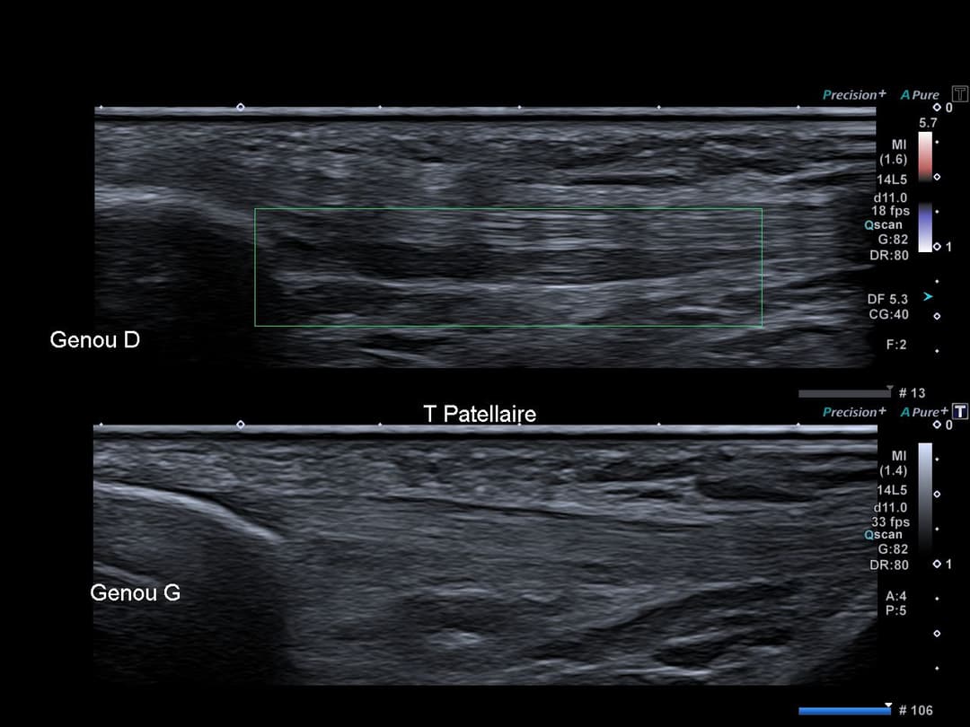 Image échographique