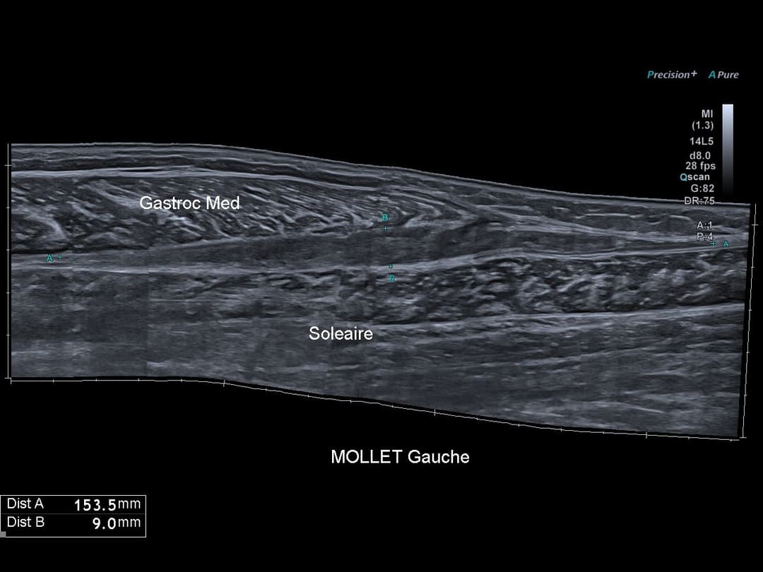 Image échographique