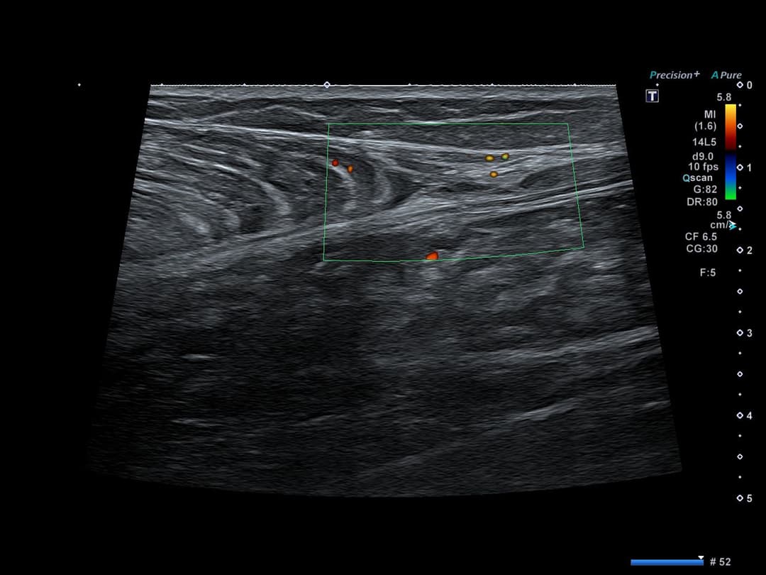 Image échographique