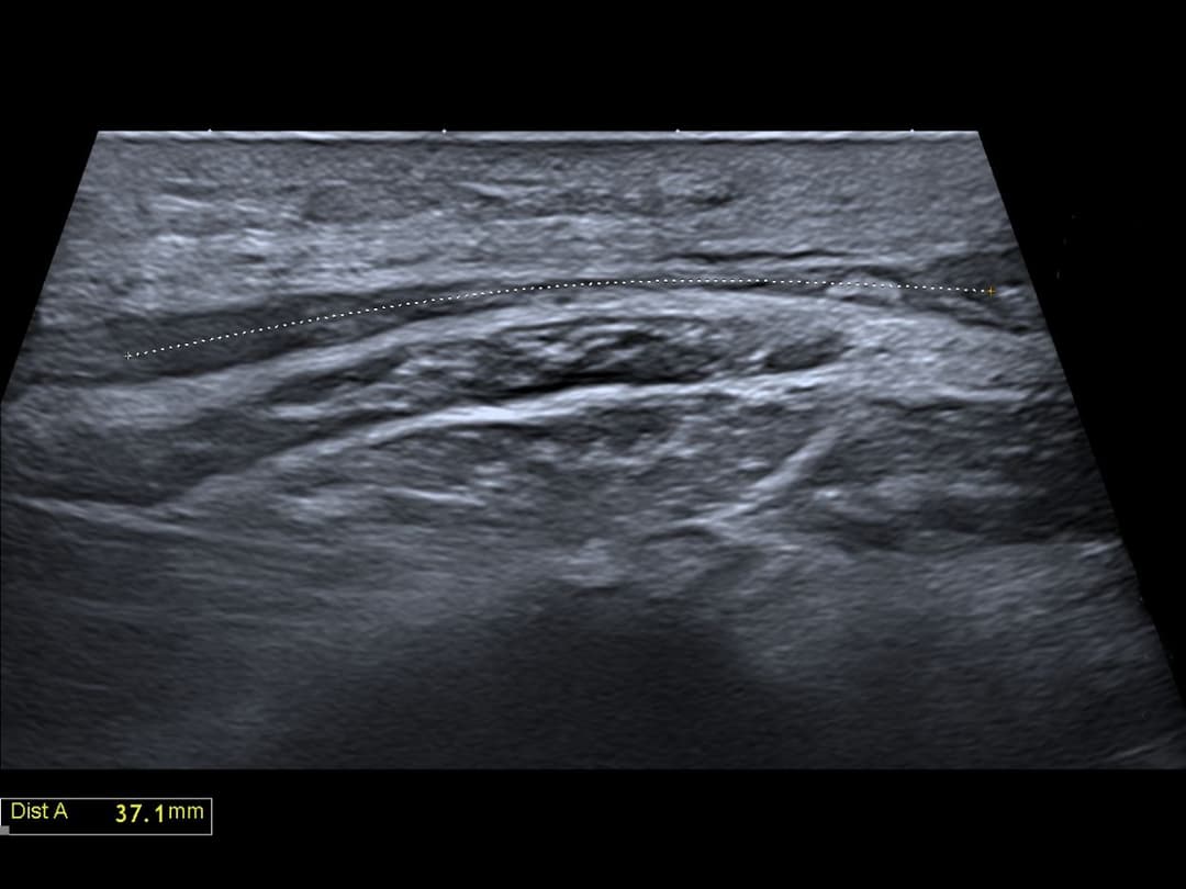 Image échographique