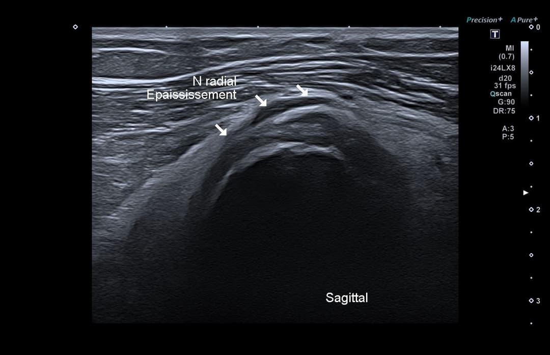Image échographique